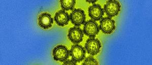 Influenza-Viren nutzen Proteine auf der Oberfläche (schwarz), um Zellen der Atemwege zu infizieren.