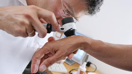Ein Hautarzt untersucht am in seiner Praxis mit einem Vergrößerungsglas die Haut einer Patientin bei einer Hautkrebs-Früherkennung. Künstliche Intelligenz konnte, einer Studie zufolge, unter bestimmten Testbedingungen Hautkrebs besser diagnostizieren als Dermatologen.