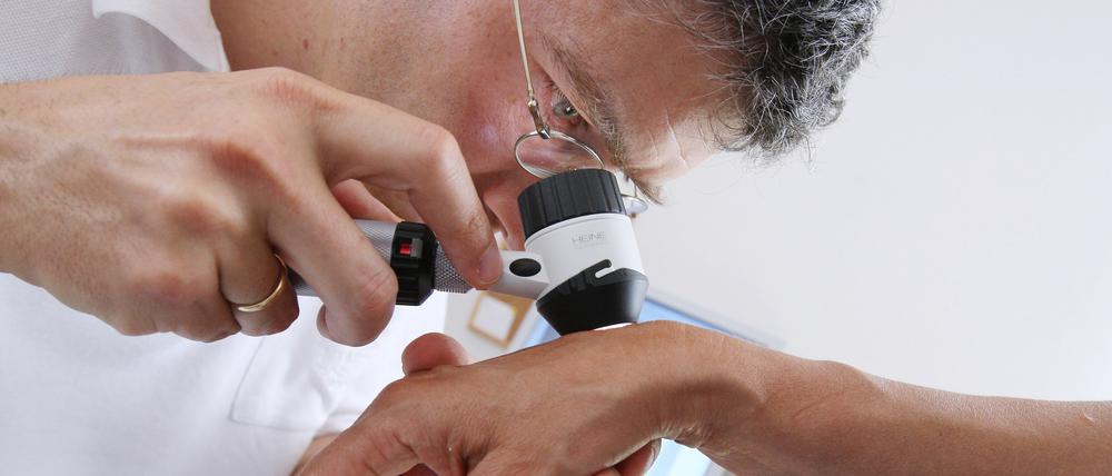 Ein Hautarzt untersucht am in seiner Praxis mit einem Vergrößerungsglas die Haut einer Patientin bei einer Hautkrebs-Früherkennung. Künstliche Intelligenz konnte, einer Studie zufolge, unter bestimmten Testbedingungen Hautkrebs besser diagnostizieren als Dermatologen.