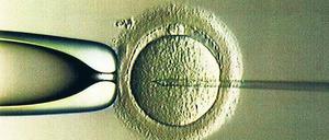 Austauschmanöver. Britische Forscher haben die Zellkerne eines menschlichen Embryos in eine andere Eizelle überführt. Die Mitochondrien des neuen Embryos stammen von der Spendermutter. So könnten Erbkrankheiten der Mitochondrien verhindert werden. Foto: dpa