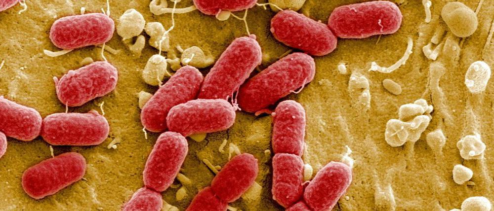 Eine elektronenmikroskopische Aufnahme von EHEC-Bakterien, einer gefährlichen Variante des harmlosen Darmbewohners Escherichia coli.