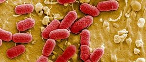 Eine elektronenmikroskopische Aufnahme von EHEC-Bakterien, einer gefährlichen Variante des harmlosen Darmbewohners Escherichia coli.