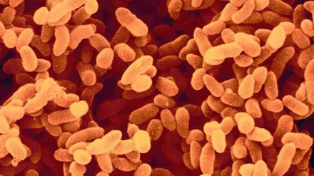 Keimende Gefahr. Bakterien wie diese Kolonie Klebsiella pneumoniae sind immer häufiger gegen fast alle Antibiotika resistent. 