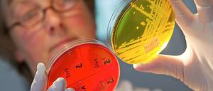 In Mecklenburg-Vorpommern haben Lebensmittelkontrolleure weitere Gurken gefunden, auf denen sie den gefährlichen EHEC-Erreger vermuten.