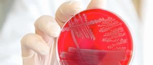 Der aggressive Darmkeim verbreitet sich weiter ungebremst.