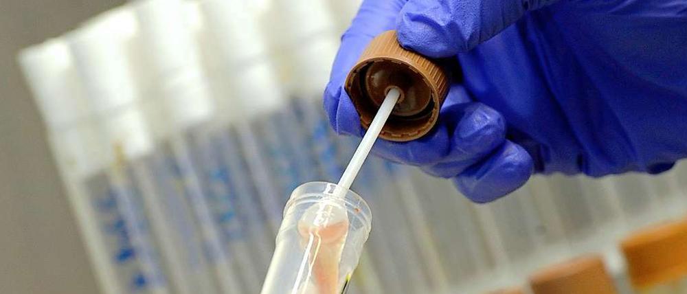 Noch ist unklar, ob der Patient in Potsdam tatsächlich an den Folgen einer Ehec-Infektion verstorben ist.