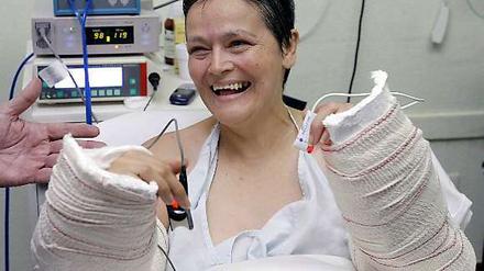 Glücklich. Eine Transplantation von kompletten Unterarmen ist selten und viel komplizierter als die Verpflanzung einer Hand. 