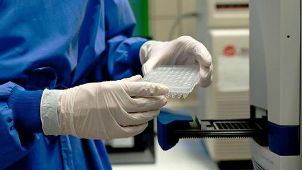 Im Landeslabor wird nach der Ursache für den Ausbruch der Magen-Darm-Epidemie gesucht.