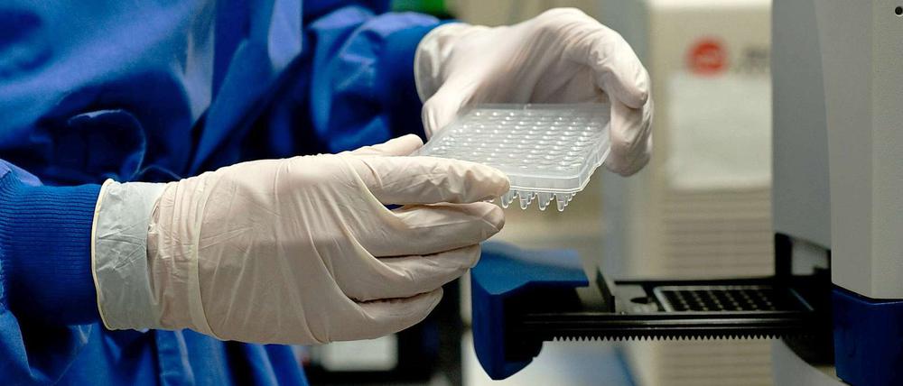 Im Landeslabor wird nach der Ursache für den Ausbruch der Magen-Darm-Epidemie gesucht.