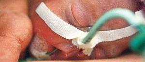 Noch nicht fertig. Bei frühen Frühchen geht es zunächst ums Überleben.