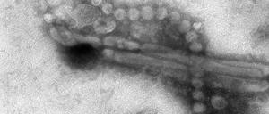 Pandemie-Kandidat. Das neue Vogelgrippevirus H7N9 unter dem Elektronenmikroskop.