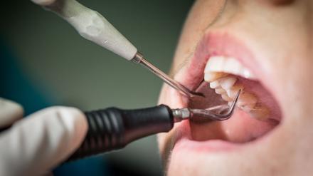 Blick ins Innere: Besonders junge Menschen mit guter Zahnhygiene brauchen nicht unbedingt eine Zahnzusatzversicherung.