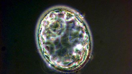 This is five day old cloned human embryo- the blastocyst, five days after nuclear transfer took place - which was created at the Centre for Life in the north England city of Newcastle by scientists Dr. Miodrag Stojkovic and Prof. Alison Murdoch and announced by them Thursday, 19 May 2005. It is the first to be created in Britain and the first to be grown in the western world. The team in Newcastle created three human clones, the most advanced being a three day old embryo the size of a full stop. The announcement came as a south Korean team also disclosed a significant cloning milestone. EPA/RBM ONLINE +++(c) dpa - Bildfunk+++ |