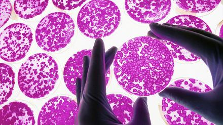 Nur scheinbar gleich. In der Petrischale sehen zu Stammzellen umprogrammierte Zellen alle gleich aus. 