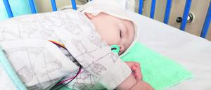 Der einjährige Michael schläft, während er eine Injektion mit dem Genpräparat Zolgensma gegen spinale Muskelatrophie bekommt. Der Schweizer Pharmakonzern Novartis will 100 Dosen des Medikaments verlosen - jede von ihnen kostet rund 2 Millionen Euro. (zu dpa "Glücksspiel ums Leben: Medikament für todkranke Babys wird verlost") +++ dpa-Bildfunk +++