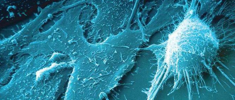 Mutierte Zellen. Der Krebs zerfraß den Körper von Henrietta Lacks, sie starb 1951. Ihre Tumorzellen jedoch sind unsterblich. Sie helfen weltweit in Laboren der medizinischen Forschung.