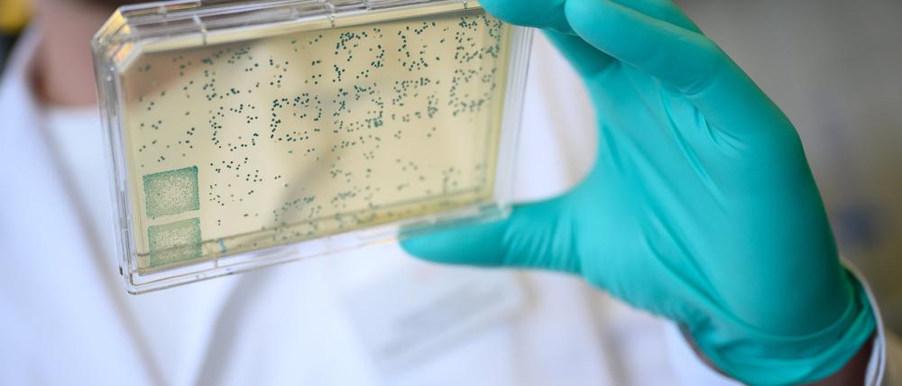 Ein Träger mit Bakterien bei Curevac, aus denen DNA und anschließend RNA gewonnen wird.