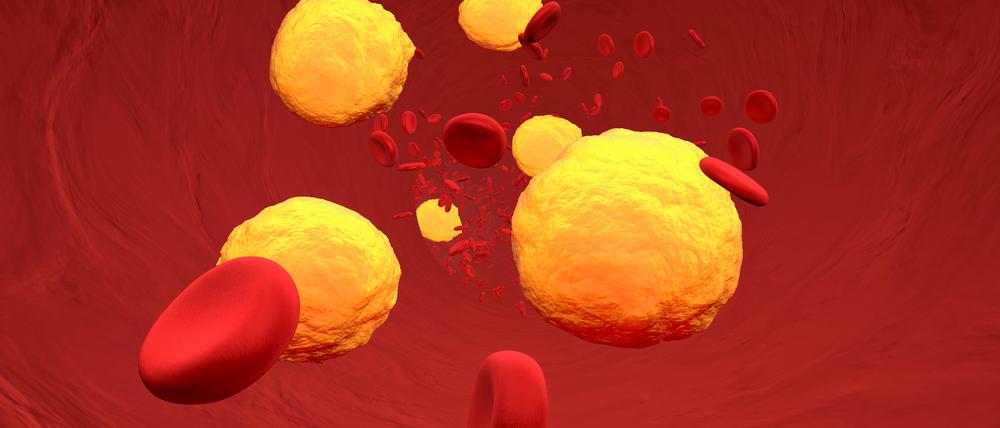 3D rendered Illustration, Cholesterol in the blood stream