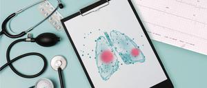 Mit mehr als drei Millionen Todesfällen weltweit belegte COPD im Jahr 2019 den dritten Platz auf der Liste der häufigsten Todesursachen - hinter der koronaren Herzerkrankung und dem Schlaganfall.