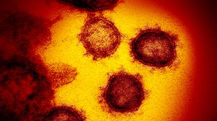HANDOUT - 01.01.2020, USA, Washington: Die vom National Institute of Allergy and Infectious Diseases zur Verfügung gestellte Elektronenmikroskopaufnahme zeigt das Coronavirus SARS-CoV-2, das von einem Patienten in den USA isoliert wurde und aus der Oberfläche von im Labor kultivierten Zellen austritt. Forscher gehen davon aus, dass sich das Coronavirus weiter verändern wird. (zu dpa «Omikron - und dann? Über neue Corona-Mutanten nur Spekulieren möglich») Foto: Niaid-Rml/ZUMA Wire/dpa +++ dpa-Bildfunk +++