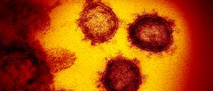 HANDOUT - 01.01.2020, USA, Washington: Die vom National Institute of Allergy and Infectious Diseases zur Verfügung gestellte Elektronenmikroskopaufnahme zeigt das Coronavirus SARS-CoV-2, das von einem Patienten in den USA isoliert wurde und aus der Oberfläche von im Labor kultivierten Zellen austritt. Forscher gehen davon aus, dass sich das Coronavirus weiter verändern wird. (zu dpa «Omikron - und dann? Über neue Corona-Mutanten nur Spekulieren möglich») Foto: Niaid-Rml/ZUMA Wire/dpa +++ dpa-Bildfunk +++