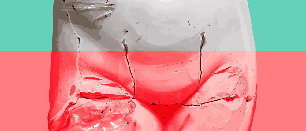 In Deutschland klafft eine große Versorgungslücke: Über das Thema Menstruationsbeschwerden wird im niedergelassenen Bereich kaum gesprochen. Dafür gibt es wirtschaftliche Gründe.