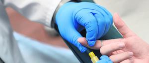 Die Situation bei der HIV-Behandlung hatte sich vor dem Krieg in der Ukraine stark verbessert. 2021 waren fast doppelt so viele Menschen in Behandlung wie 2018.
