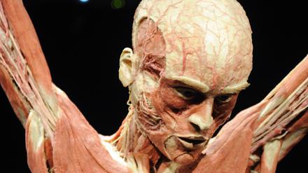 Noch toter als ein Toter - ein Hagens-Plastinat