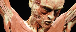 Noch toter als ein Toter - ein Hagens-Plastinat