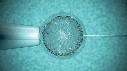 In-vitro-Befruchtung