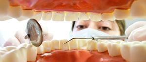 Teurer Ersatz. Ein Zahnimplantat kann schnell einige tausend Euro kosten.