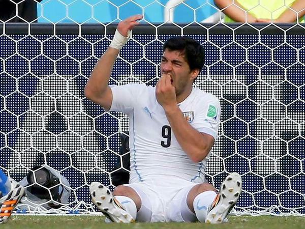 Luiz Suarez hält sich die Zähne nach seiner Beißattacke im Spiel Uruguay gegen Italien.