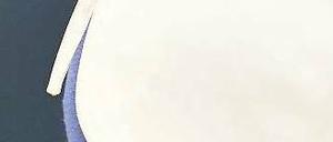 Elementar. Schwangere brauchen 230 Mikrogramm Jod pro Tag.