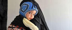 Fatima Ali Bedani mit ihrer kleinen Tochter Hidar, die nicht laufen kann, weil sie unterernährt ist. Mutter und Tochter suchen Hilfe in der Ernährungsambulanz "17. Juli" am Stadtrand von Sanaa.
