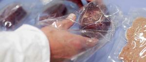 In einem Berliner Labor werden Fleischproben danach untersucht, ob sich Anteile von Pferdefleisch in ihnen befinden.