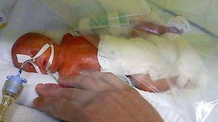 Frühchen bedürfen besonderer Pflege - sie sind besonders anfällig. Auch eigentlich harmlose Keime können ihnen gefährlich werden. 