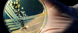 Europäische Behörden haben Samen aus Ägypten als mögliche Quelle des gefährlichen Ehec-Keims identifiziert. Ein Betrieb in Niedersachsen hat aus den Samen Sprossen hergestellt und vertrieben.