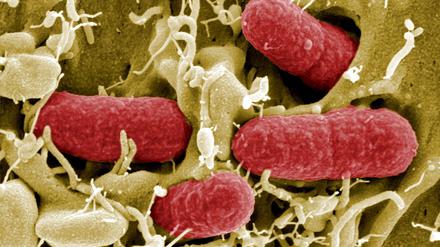 EHEC-Keime sind eine besonders gefährliche Form des Darmbakteriums Escherichia coli.