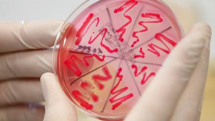 Schwere Darmerkrankungen mit dem gefährlichen EHEC-Erreger breiten sich in Deutschland weiter aus.