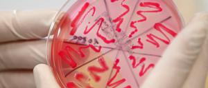 Schwere Darmerkrankungen mit dem gefährlichen EHEC-Erreger breiten sich in Deutschland weiter aus.