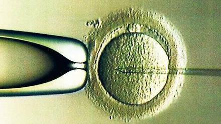 Geschützt. Viele Frauen machen sich zu Unrecht nach einer künstlichen Befruchtung Sorgen, dass persönliche Probleme die Schwangerschaft gefährden. Das Foto zeigt die Befruchtung einer Eizelle (Mitte) mit einer Samenzelle über eine feine Hohlnadel (rechts). Foto: p-a/dpa