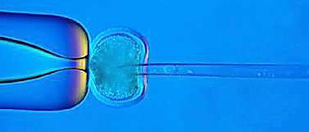 Es geht auch sachlich. Gegner und Befürworter der Präimplantationsdiagnostik debattierten am Donnerstag im Bundestag.