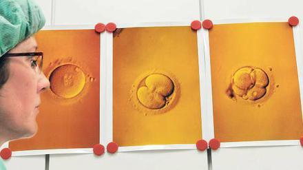 Am Anfang. Eine Laborantin verfolgt das Wachstum eines Embryos in der Petrischale nach künstlicher Befruchtung. 