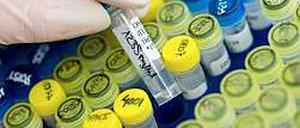 Charité-Forscher entwickelten ein neues Verfahren zur Gensequenzierung.