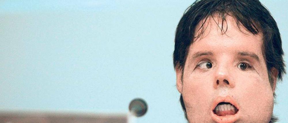 Anonym. Der 31-jährige Patient ist nur als Oscar bekannt. Foto:dpa