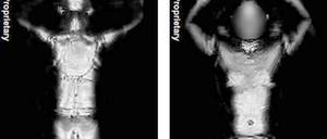 Nackt-Scanner
