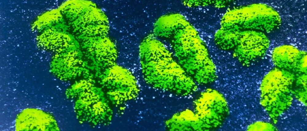 Chromosomen