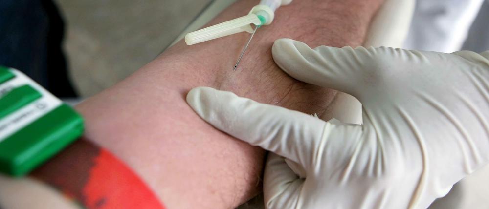 Ab Januar 2014 soll Schluss sein mit den anonymen HIV-Schnelltests.