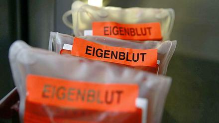 Lance Armstrong gestand die Einnahme verschiedener Dopingmittel, sowie die Anwendung von Eigenblutdoping zur Leistungssteigerung.