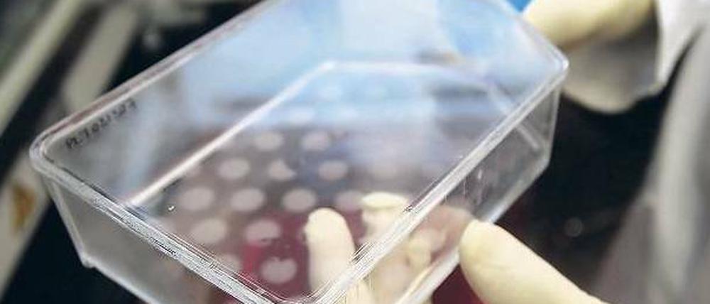 Umstrittene Forschung. In Deutschland dürfen Produkte nicht patentiert werden, wenn dafür in der Vergangenheit Embryonen zerstört werden mussten. Der Bundesgerichtshof hat diese Regelung jetzt nochmals bestätigt. Foto: John Bazemore/AP/dapd